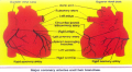 Ischemic Heart Disease.PNG